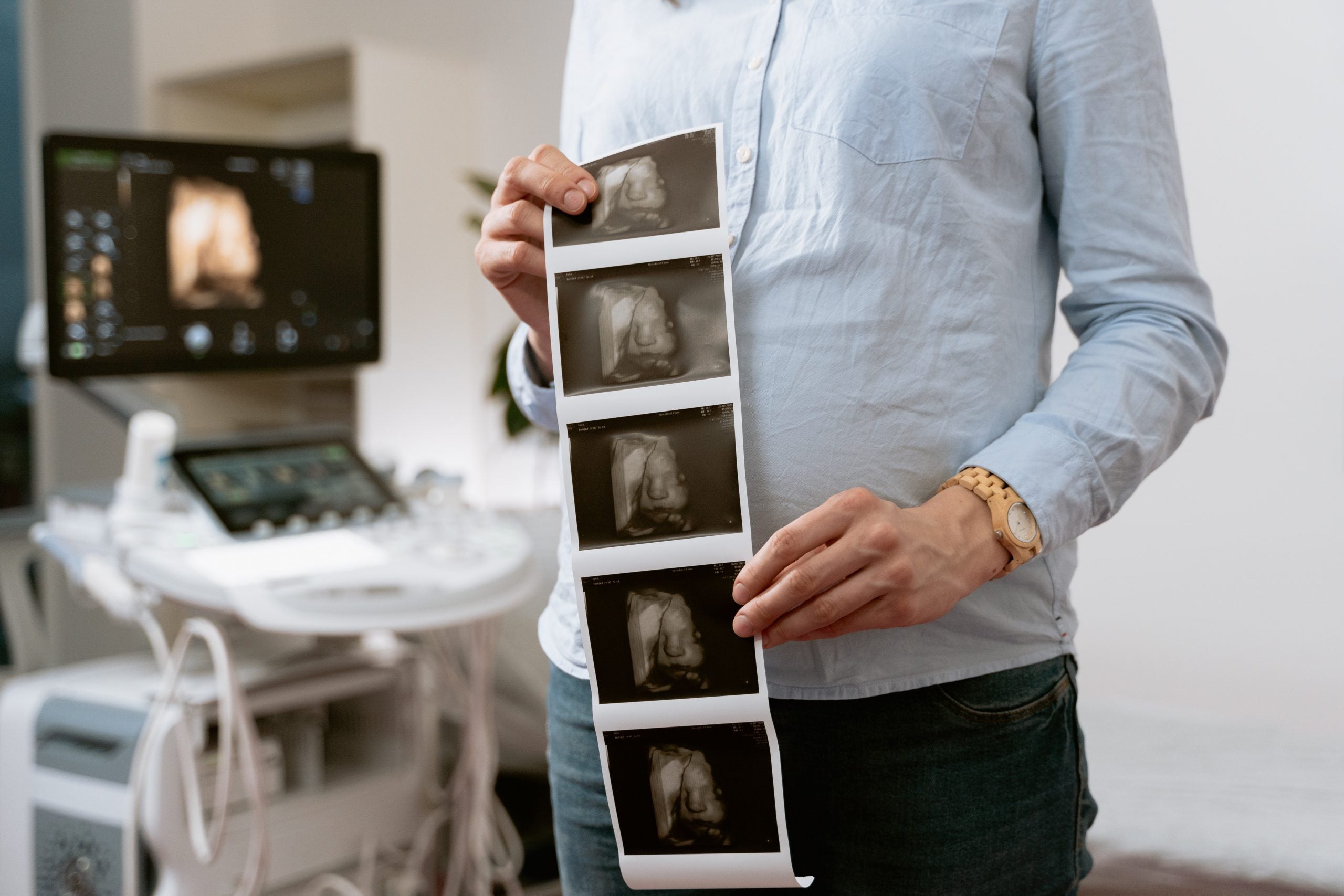 ▷ Predecir el sexo del bebé: ¿Es posible?